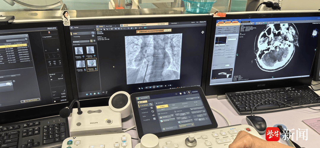 买球的正规网站
_36岁青年男性突发脑梗死买球的正规网站
,病因竟是心脏上有个“洞”!